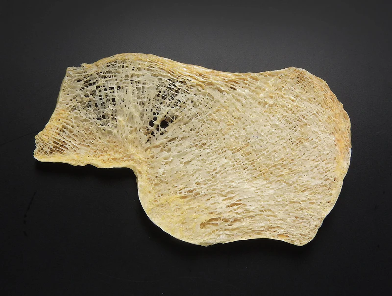 Cross-section of human bone tissue