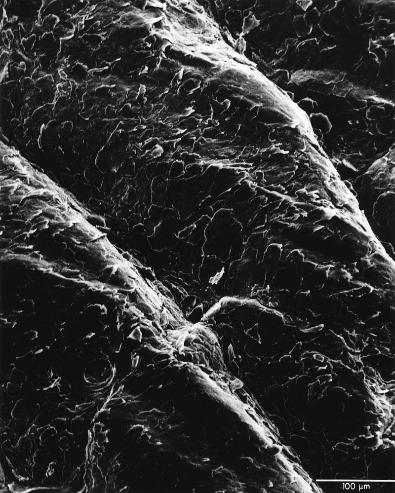 Scanning electron microscope image of the surface of human skin